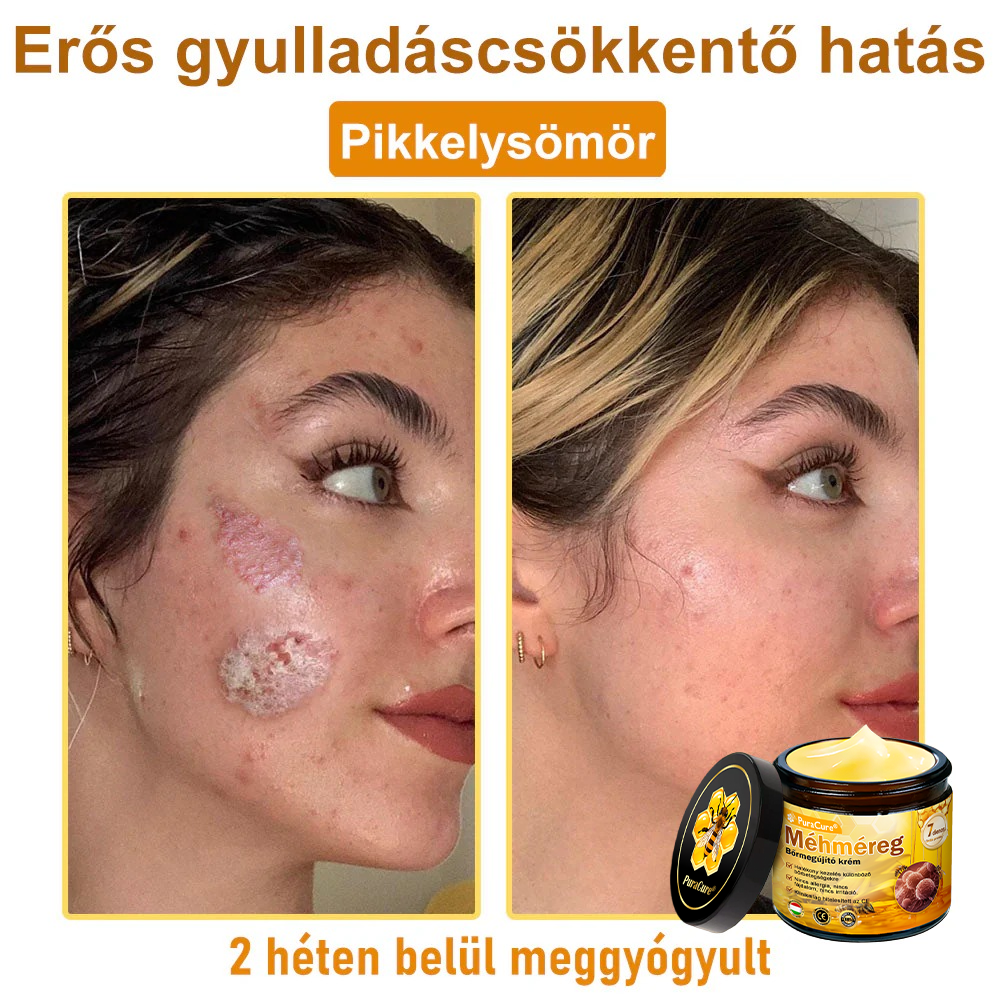 ✨ 𝐏𝐮𝐫𝐚𝐂𝐮𝐫𝐞® 𝐌é𝐡𝐦é𝐫𝐞𝐠 𝐁ő𝐫 𝐇𝐞𝐥𝐲𝐫𝐞á𝐥𝐥í𝐭ó 𝐊𝐫é𝐦 (👨‍⚕‍𝐂𝐄 𝐓𝐚𝐧ú𝐬í𝐭𝐯á𝐧𝐲)👍✅