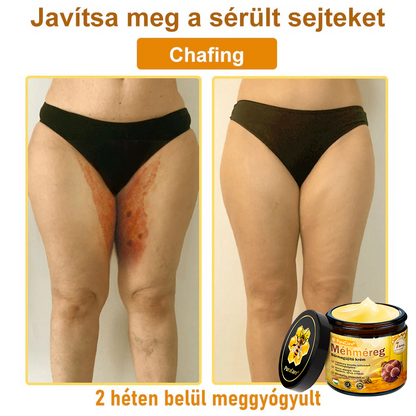 ✨ 𝐏𝐮𝐫𝐚𝐂𝐮𝐫𝐞® 𝐌é𝐡𝐦é𝐫𝐞𝐠 𝐁ő𝐫 𝐇𝐞𝐥𝐲𝐫𝐞á𝐥𝐥í𝐭ó 𝐊𝐫é𝐦 (👨‍⚕‍𝐂𝐄 𝐓𝐚𝐧ú𝐬í𝐭𝐯á𝐧𝐲)👍✅