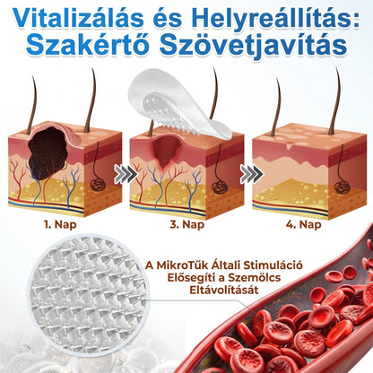 🎁 Már csak 5 doboz maradt. További 30%-os kedvezményt kínálunk Önnek! Ha most elszalasztja ezt a lehetőséget, jövőre már nem lesz rá esélye.
