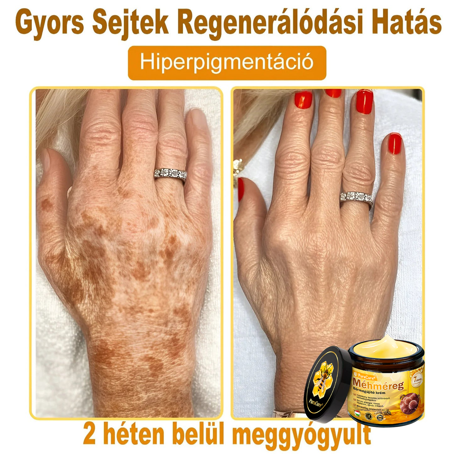✨ 𝐏𝐮𝐫𝐚𝐂𝐮𝐫𝐞® 𝐌é𝐡𝐦é𝐫𝐞𝐠 𝐁ő𝐫 𝐇𝐞𝐥𝐲𝐫𝐞á𝐥𝐥í𝐭ó 𝐊𝐫é𝐦 (👨‍⚕‍𝐂𝐄 𝐓𝐚𝐧ú𝐬í𝐭𝐯á𝐧𝐲)👍✅