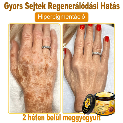 ✨ 𝐏𝐮𝐫𝐚𝐂𝐮𝐫𝐞® 𝐌é𝐡𝐦é𝐫𝐞𝐠 𝐁ő𝐫 𝐇𝐞𝐥𝐲𝐫𝐞á𝐥𝐥í𝐭ó 𝐊𝐫é𝐦 (👨‍⚕‍𝐂𝐄 𝐓𝐚𝐧ú𝐬í𝐭𝐯á𝐧𝐲)👍✅