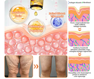 ✨ 𝐏𝐮𝐫𝐚𝐂𝐮𝐫𝐞® 𝐌é𝐡𝐦é𝐫𝐞𝐠 𝐁ő𝐫 𝐇𝐞𝐥𝐲𝐫𝐞á𝐥𝐥í𝐭ó 𝐊𝐫é𝐦 (👨‍⚕‍𝐂𝐄 𝐓𝐚𝐧ú𝐬í𝐭𝐯á𝐧𝐲)👍✅