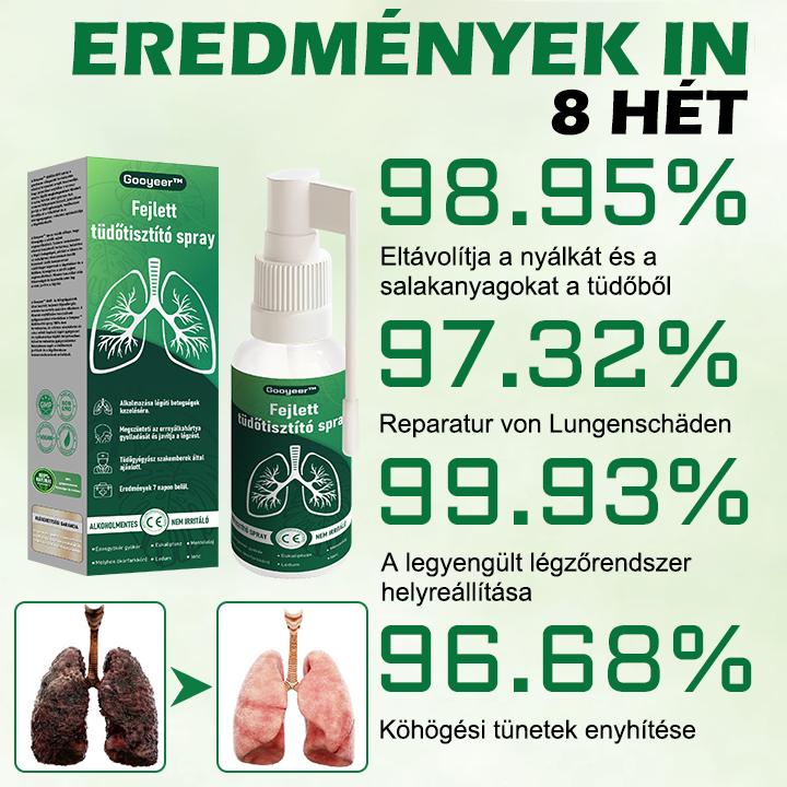 🍈𝐆𝐨𝐨𝐲𝐞𝐞𝐫™ Fejlett Tüdőtisztító Spray -Támogatja a tüdő, a hörgők és az orrmelléküregek egészségét, elősegíti a légzőrendszer egészségét és a könnyebb légzést