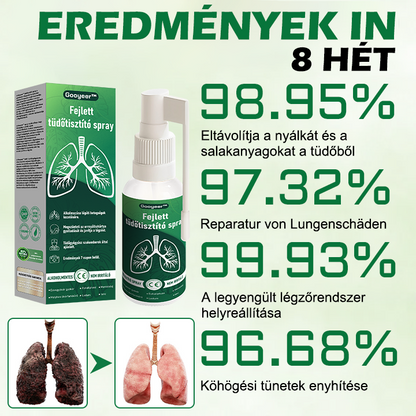 🍈𝐆𝐨𝐨𝐲𝐞𝐞𝐫™ Fejlett Tüdőtisztító Spray -Támogatja a tüdő, a hörgők és az orrmelléküregek egészségét, elősegíti a légzőrendszer egészségét és a könnyebb légzést