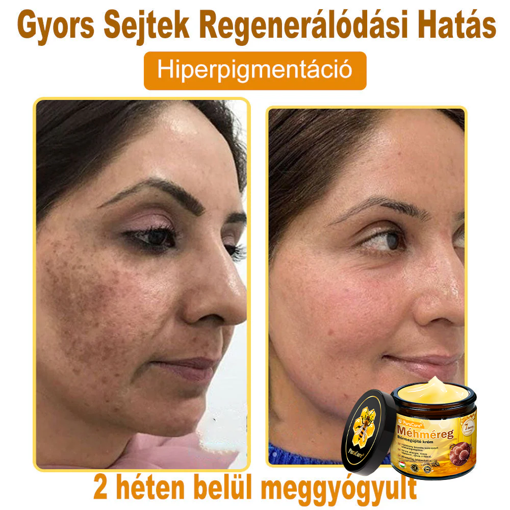 ✨ 𝐏𝐮𝐫𝐚𝐂𝐮𝐫𝐞® 𝐌é𝐡𝐦é𝐫𝐞𝐠 𝐁ő𝐫 𝐇𝐞𝐥𝐲𝐫𝐞á𝐥𝐥í𝐭ó 𝐊𝐫é𝐦 (👨‍⚕‍𝐂𝐄 𝐓𝐚𝐧ú𝐬í𝐭𝐯á𝐧𝐲)👍✅