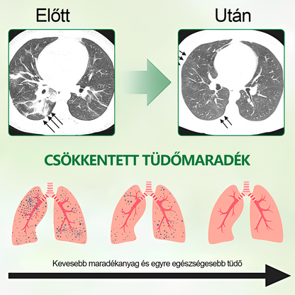 🍈𝐆𝐨𝐨𝐲𝐞𝐞𝐫™ Fejlett Tüdőtisztító Spray -Támogatja a tüdő, a hörgők és az orrmelléküregek egészségét, elősegíti a légzőrendszer egészségét és a könnyebb légzést