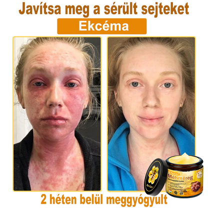 ✨ 𝐏𝐮𝐫𝐚𝐂𝐮𝐫𝐞® 𝐌é𝐡𝐦é𝐫𝐞𝐠 𝐁ő𝐫 𝐇𝐞𝐥𝐲𝐫𝐞á𝐥𝐥í𝐭ó 𝐊𝐫é𝐦 (👨‍⚕‍𝐂𝐄 𝐓𝐚𝐧ú𝐬í𝐭𝐯á𝐧𝐲)👍✅