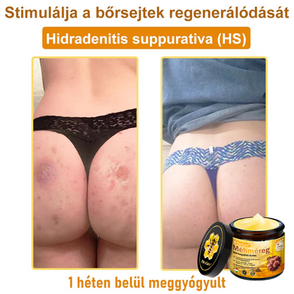 ✨ 𝐏𝐮𝐫𝐚𝐂𝐮𝐫𝐞® 𝐌é𝐡𝐦é𝐫𝐞𝐠 𝐁ő𝐫 𝐇𝐞𝐥𝐲𝐫𝐞á𝐥𝐥í𝐭ó 𝐊𝐫é𝐦 (👨‍⚕‍𝐂𝐄 𝐓𝐚𝐧ú𝐬í𝐭𝐯á𝐧𝐲)👍✅